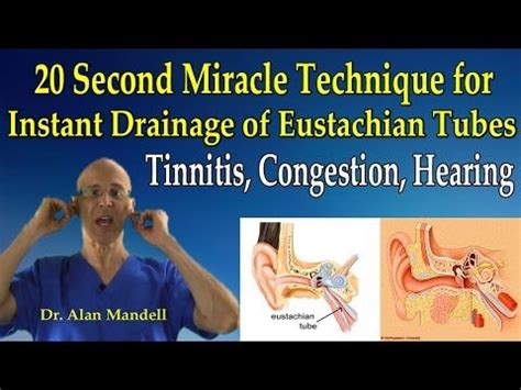 The <b>Eustachian</b> <b>tube</b> needs to be open during normal swallowing, as just that noise could damage the sensitive nerve endings and structures in the inner ear. . Blocked eustachian tube finger sweep